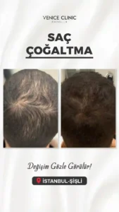 venıce oncesı sonrası1 (1)